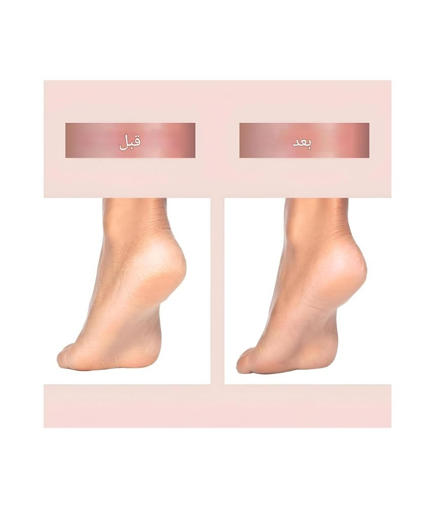 http://ecomerg.com/uploads/products_images/3905/JetWSyfU57AYBJvCeOViMiOtu0hwOMZUwIDOVmvE.jpg