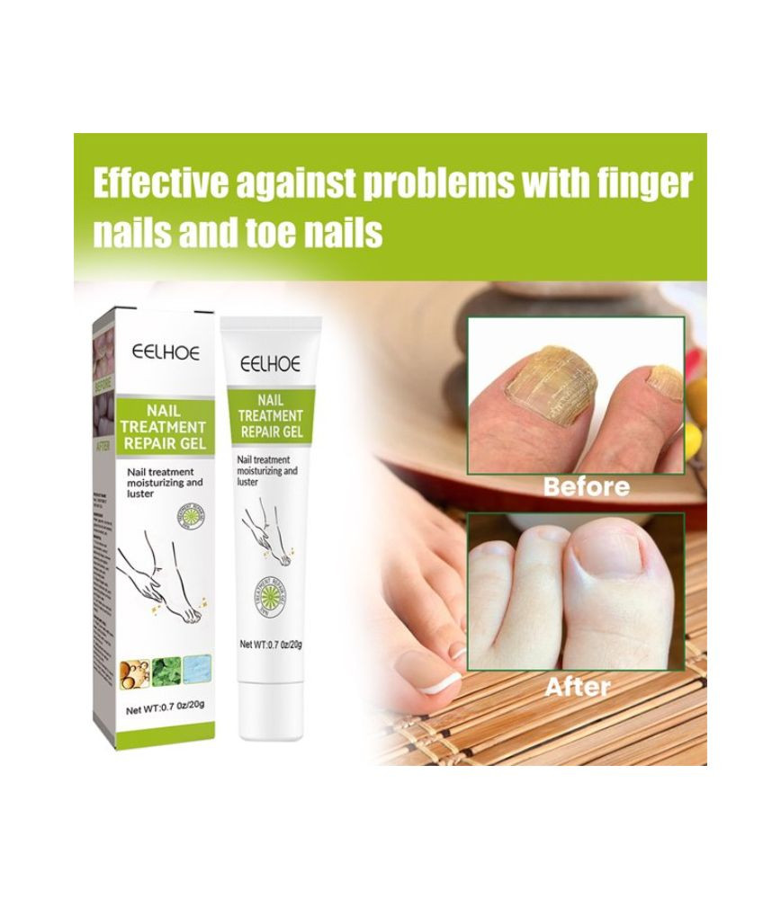 جل إصلاح وعناية الأظافر Eelhoe Nail Treatment Repair Gel