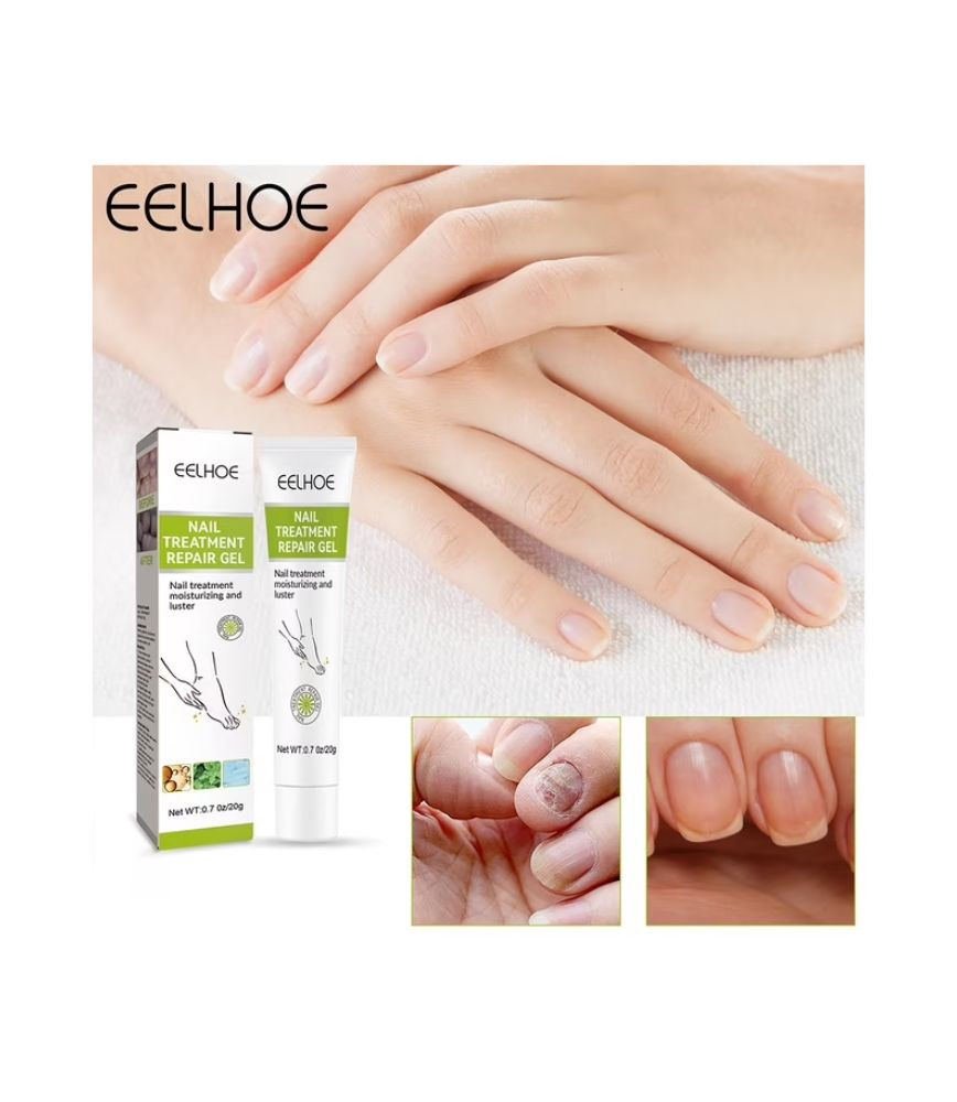 جل إصلاح وعناية الأظافر Eelhoe Nail Treatment Repair Gel