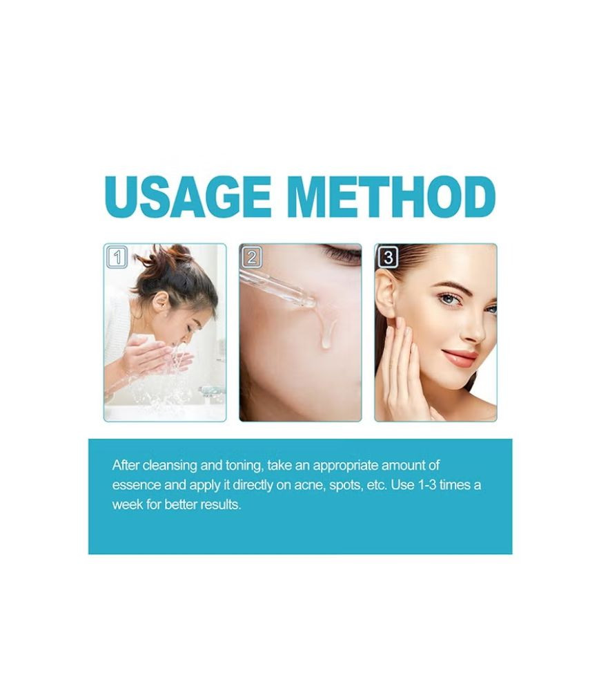 سيروم BIOAQUA لعلاج حب الشباب وتجديد البشرة