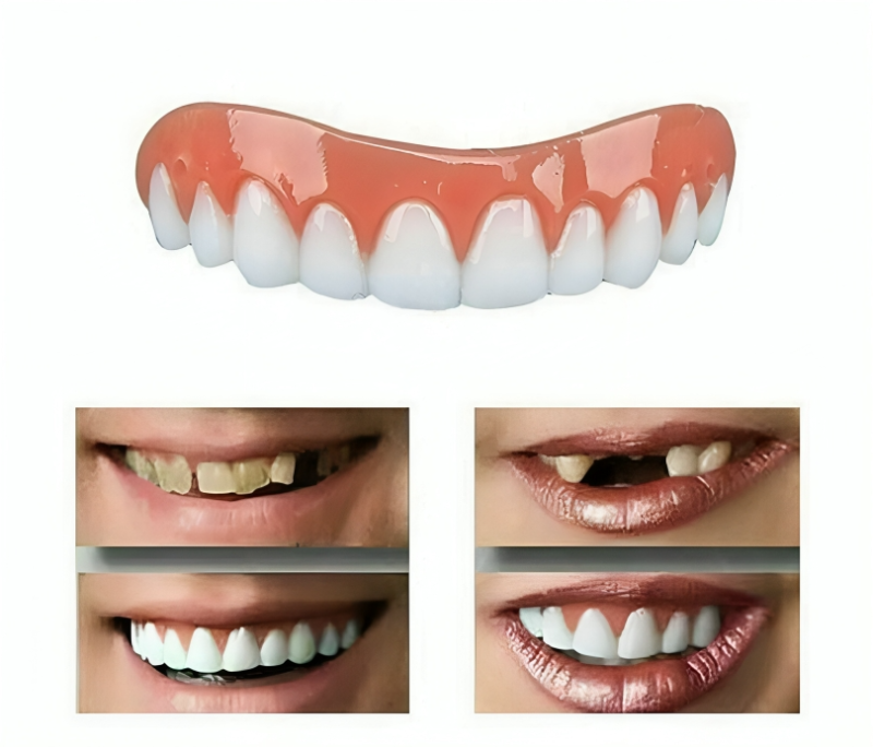 طقم تجميل الأسنان العلوية