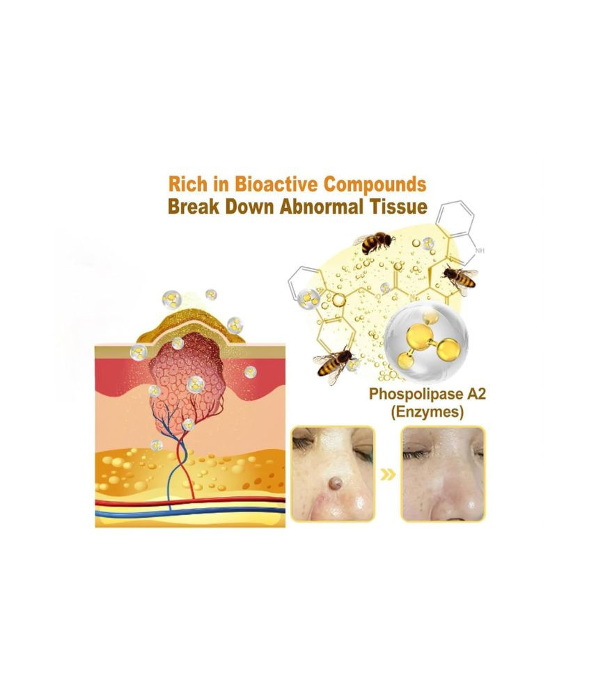 كريم علاج البشرة بسم النحل الطبيعي Bee Venom Treatment Cream - صورة 2