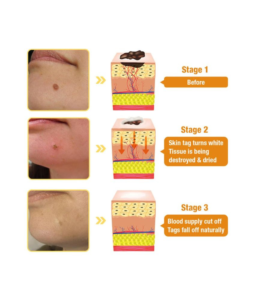 كريم علاج البشرة بسم النحل الطبيعي Bee Venom Treatment Cream