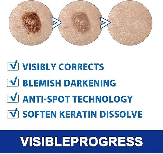 عرض 3 قطع من مرهم إزالة الزوائد الجلدية