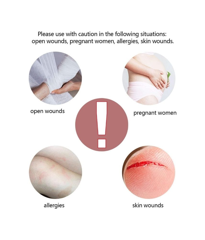 كريم الصدفية والإكزيما الطبيعي